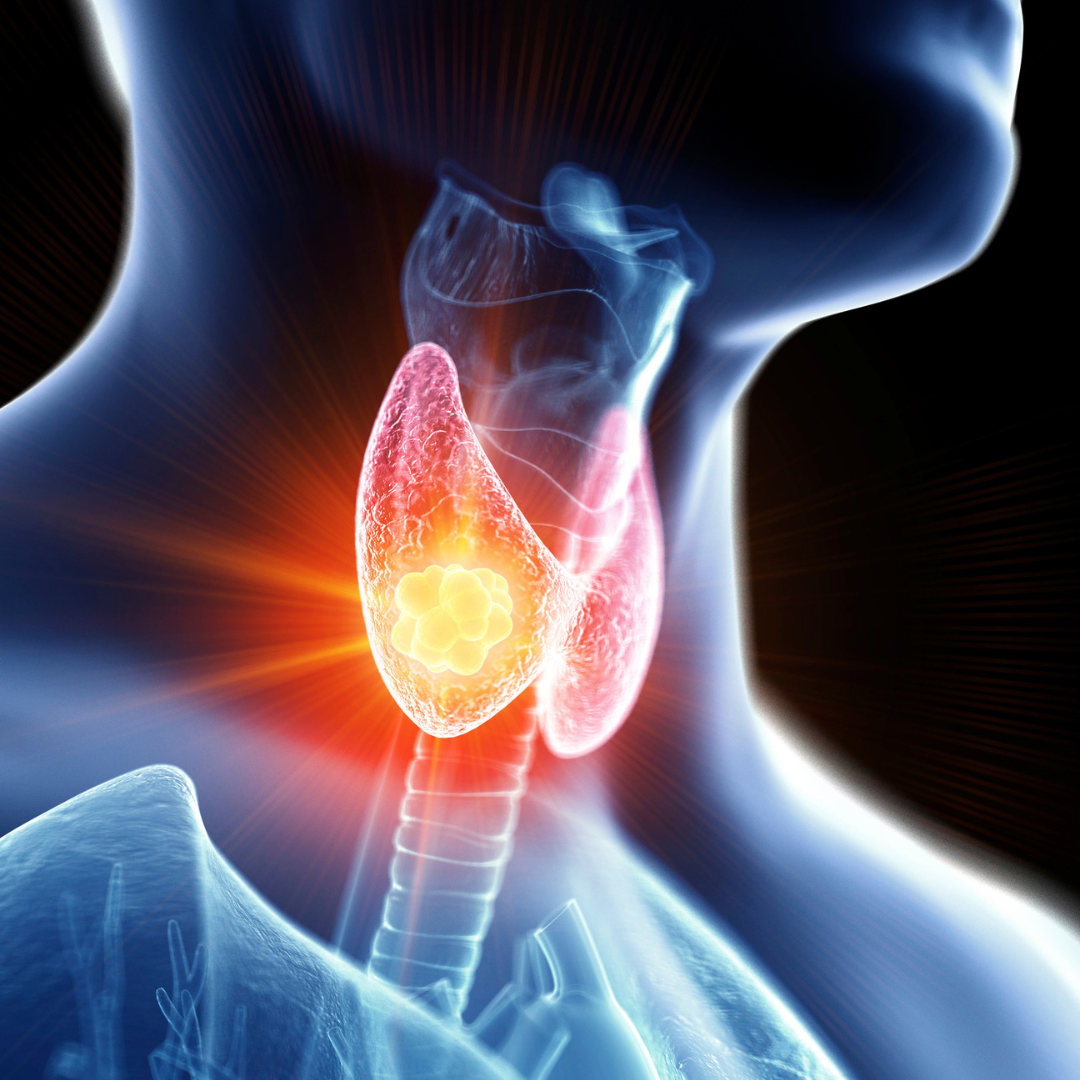 Thyroid gland highlighted in the neck